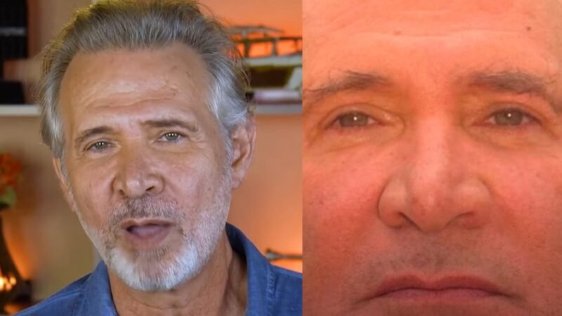 Aos 63 anos Nelson Freitas faz harmonizacao facial veja o