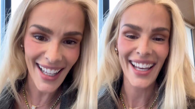 Menos 25 kg Yasmin Brunet choca ao mostrar antes e